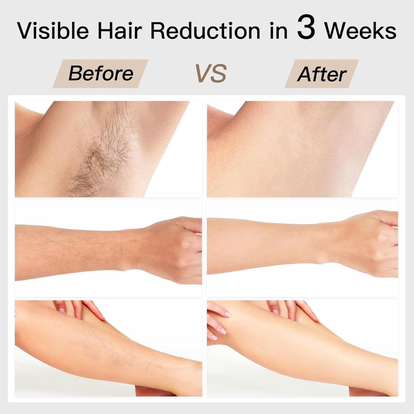 Laser Hair Removal, BoSidin IPL Hair Removal with Painless Ice-Cooling, 2-in-1 Face SR Rejuvenation, 6+1 Modes, 6 Levels Hair Removal - SmartGatelb