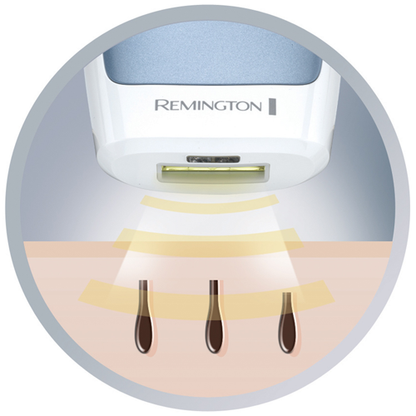 Remington i-Light Essential IPL Hair Removal System – Safe, Effective & Long-Lasting - SmartGatelb